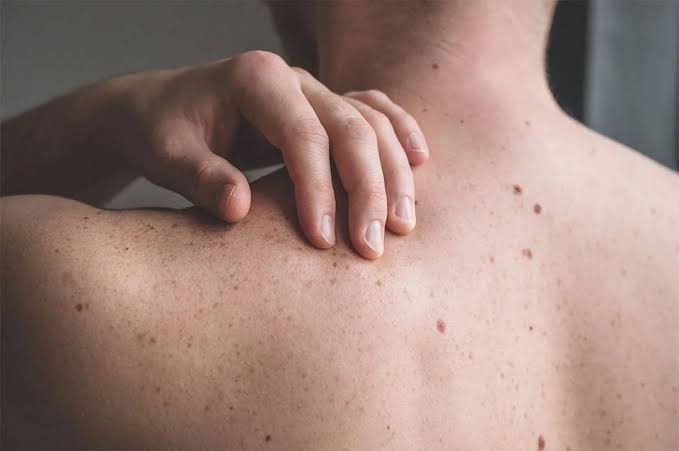 Skin & Allergy Care